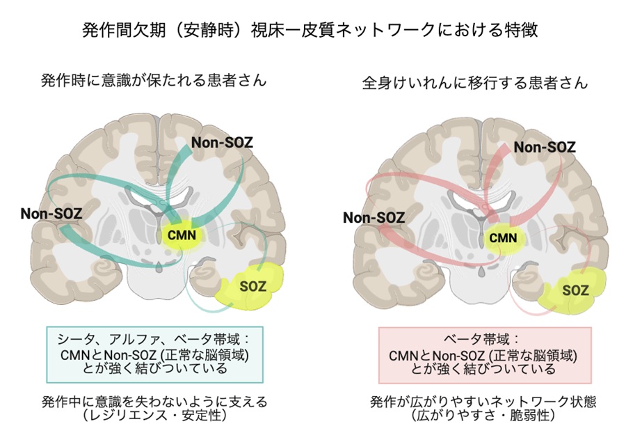 横浜市立大学】てんかん発作時の意識障害に関わる視床-皮質