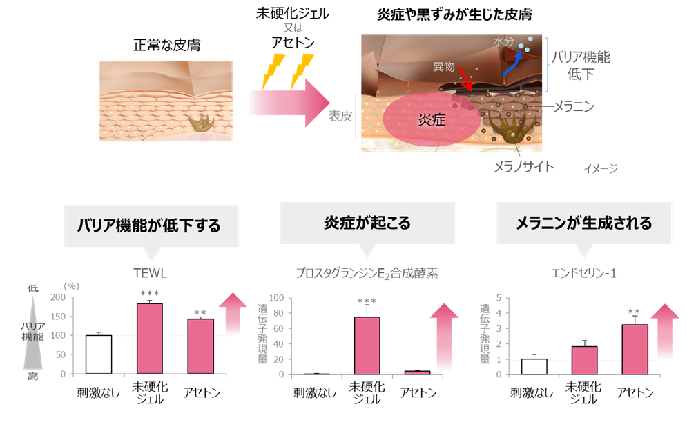 「ネイルを楽しむ」が、ときに皮膚トラブルにつながることも？　手湿疹にはステロイド外用剤による早めの対処が大切