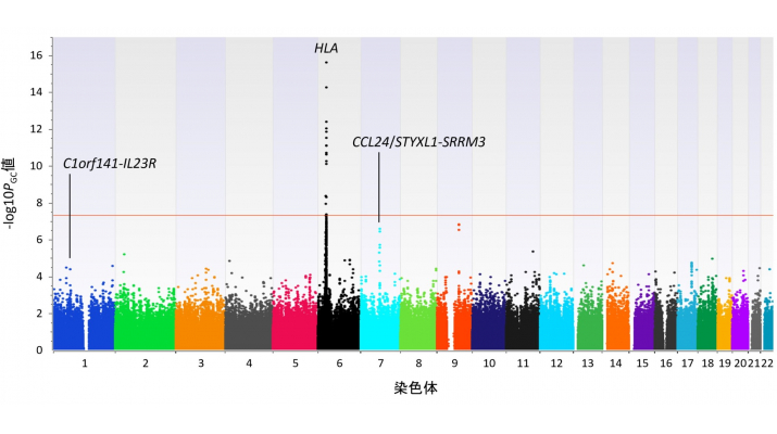 医師はサルコイドーシスをどのように診断しますか?