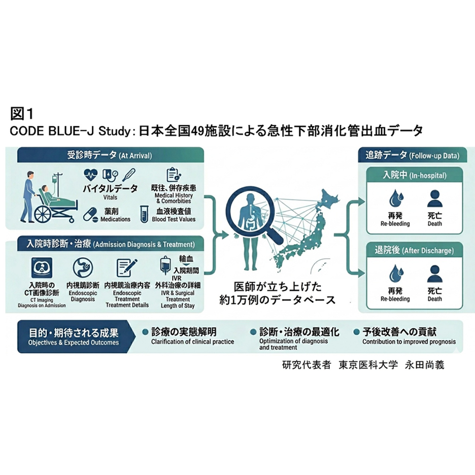 リリース
