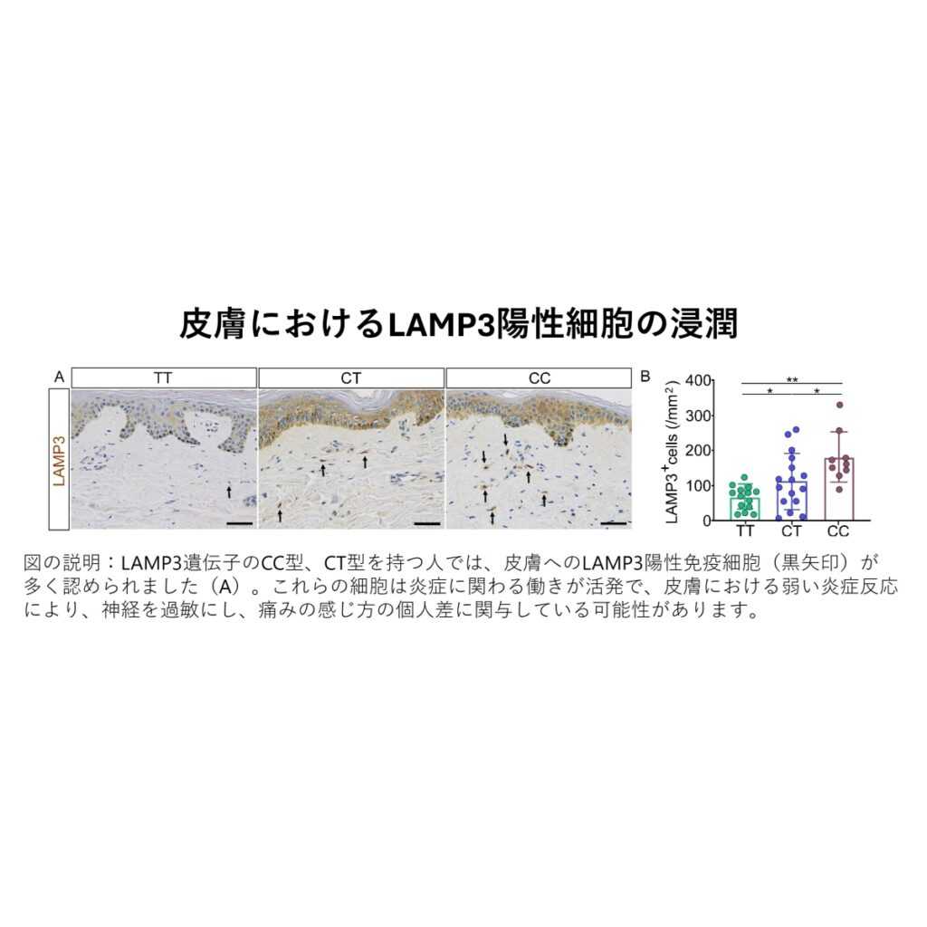 リリース