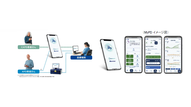 Mypd 腹膜透析の治療データを医療者と共有するアプリMyPD が登場 ~CAPD の治療環境もリモート管理で「おうち透析(腹膜透析)」に安心感を ...