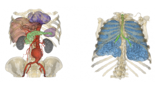 中高生対象のオープンラボ「ひらめき☆ときめきサイエンス」開催　物理学の観点から見る医学の世界を体験しよう